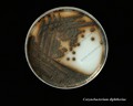corynebacterium diphtheriae